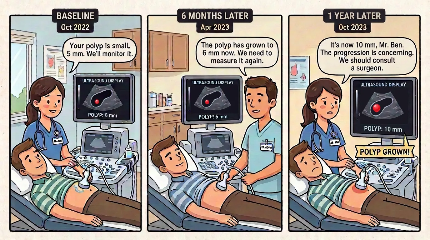 Three ultrasound panels of the same gallbladder over time, showing a polyp measured at 5 mm at baseline, 6 mm at six months, and 10 mm at one year.