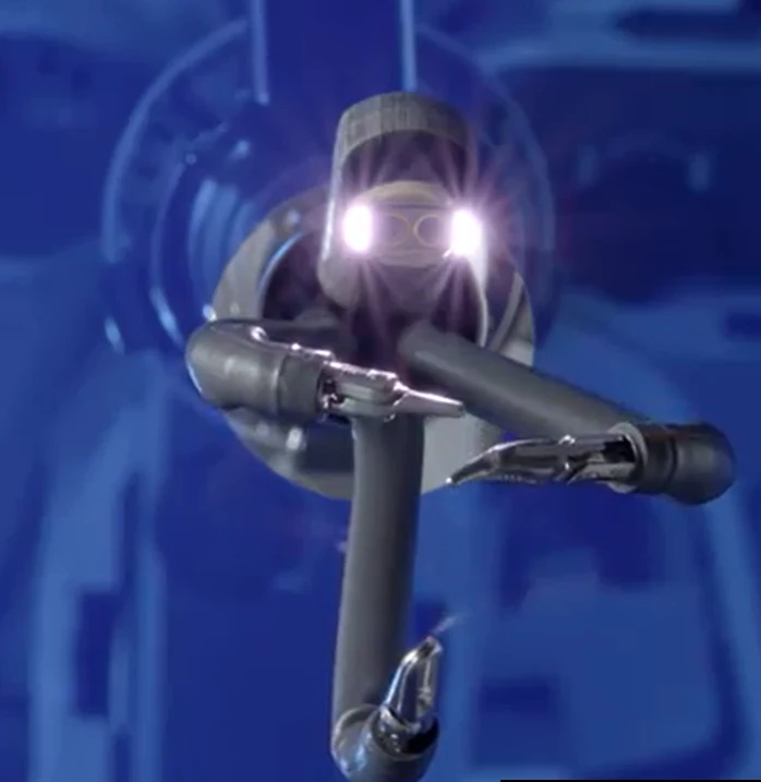 The single-port robotic system. A camera and three jointed instruments come out of one tube and spread apart inside the abdomen.